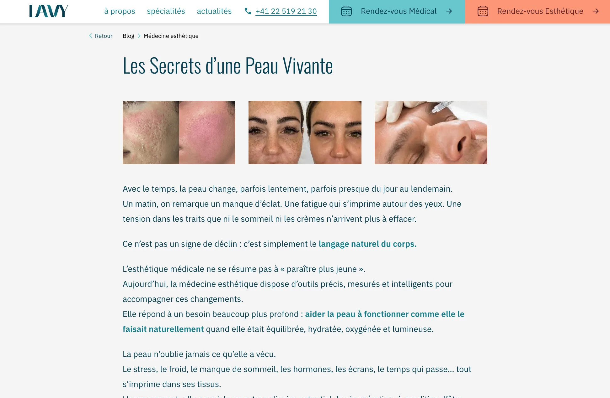 LAVY Médical - Article santé détaillé